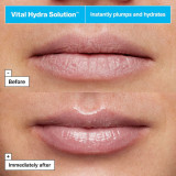 Lip balm DR.JART+ VITAL HYDRA SOLUTION 20 ml